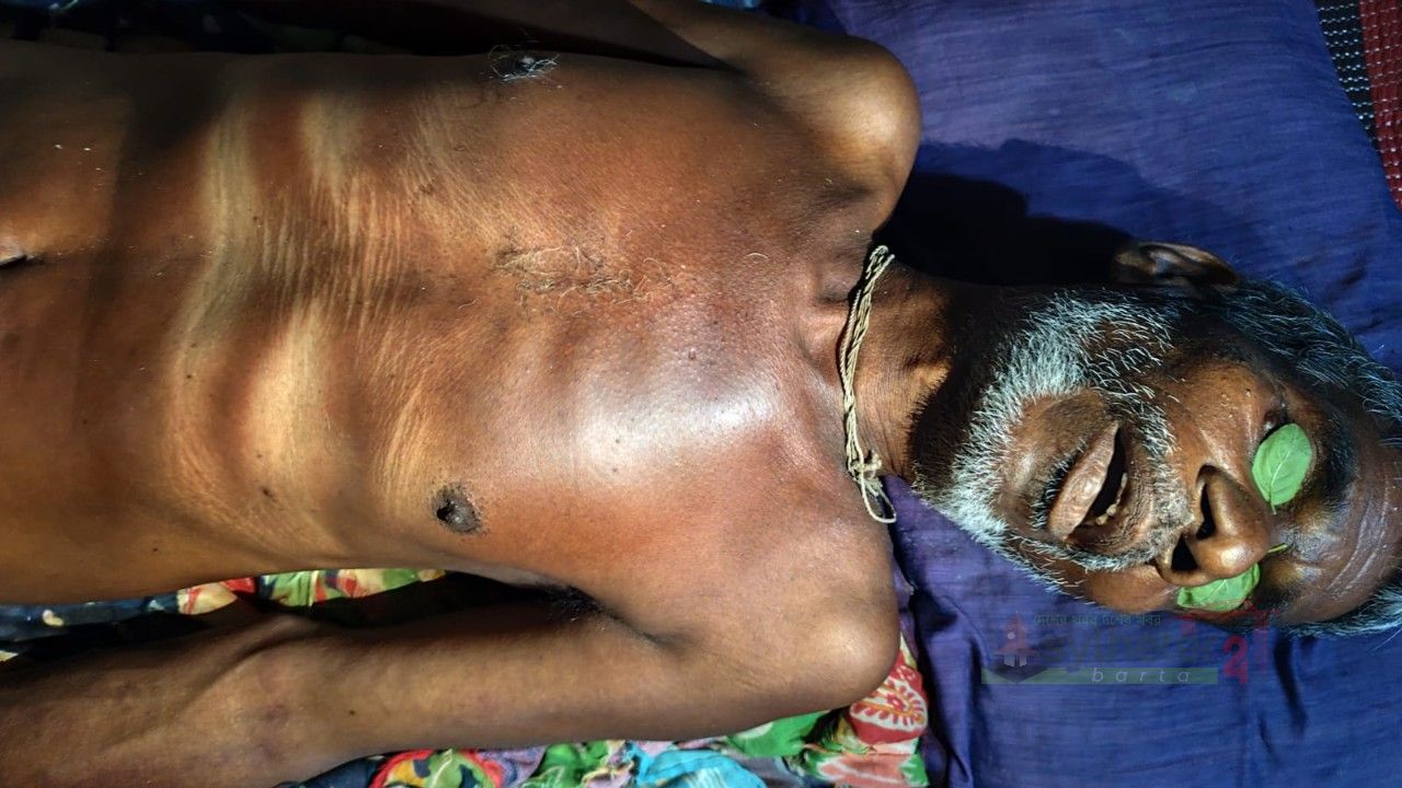 মৌলভীবাজারে বজ্রপাতে চা শ্রমিকের মৃত্যু 