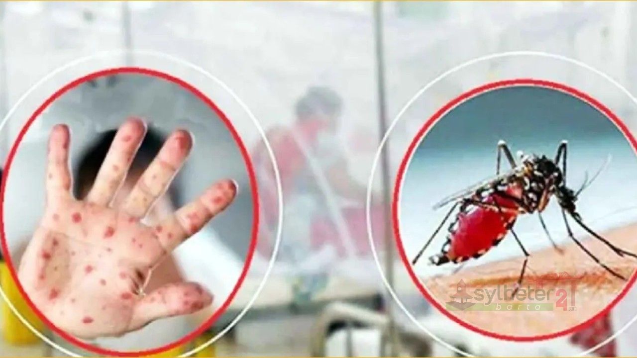 একদিনে হাম-ডেঙ্গু কেড়ে নিল ৮ প্রাণ